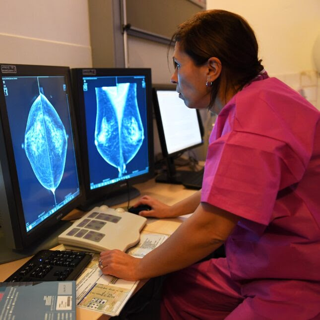 mammogram