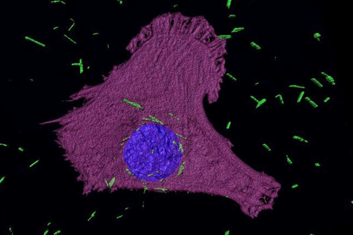 Golden nanotubes can be seen in green making their way into the cancer cell