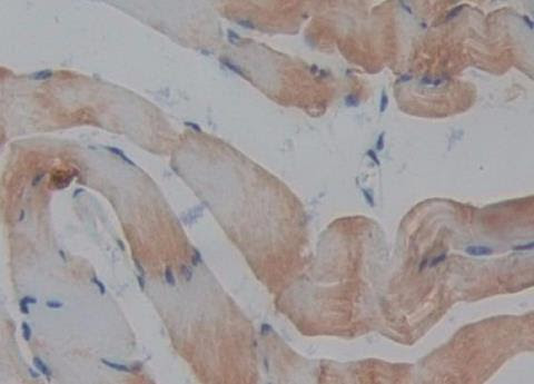 IHC-P analysis of Mouse Skeletal Muscle Tissue, with DAB staining.