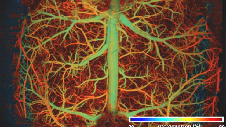 Using light and sound to reveal rapid brain activity in unprecedented detail