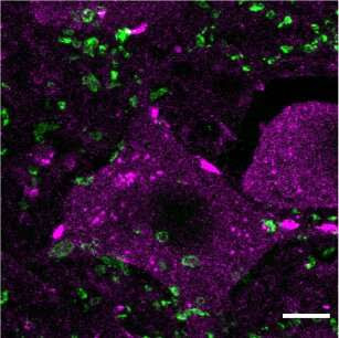 Epigenetic treatment in mice improves spinal cord regeneration after injury