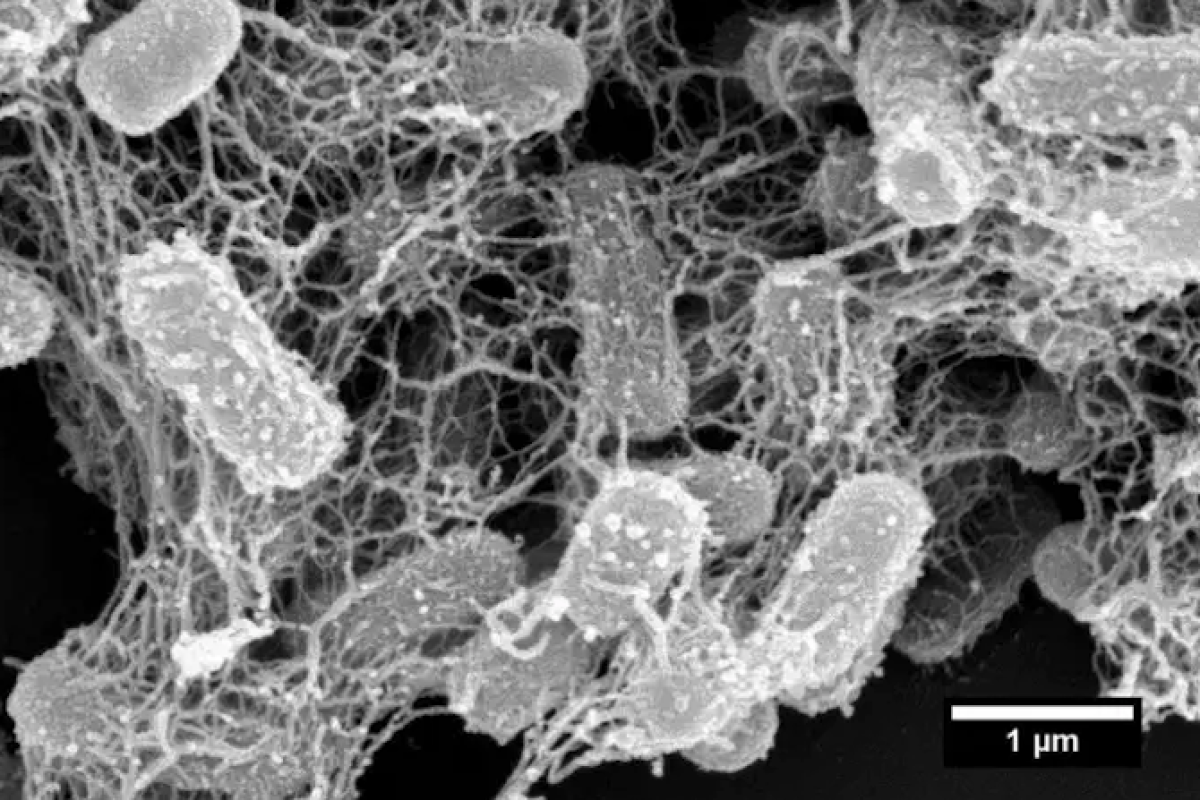 A scanning electron microscope image of E. coli ensnared in a nanonet