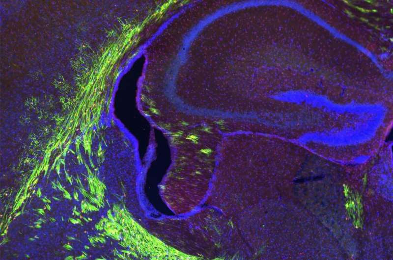 A special omega-3 fatty acid lipid will change how we look at the developing and ageing brain, Duke-NUS researchers find