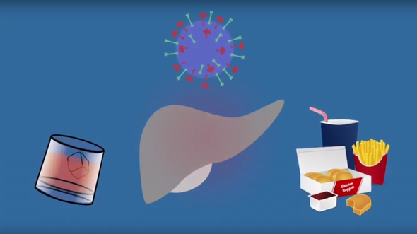 liver animation showing factors that lead to fibrosis, including hepatitis C, alcohol and fatty food