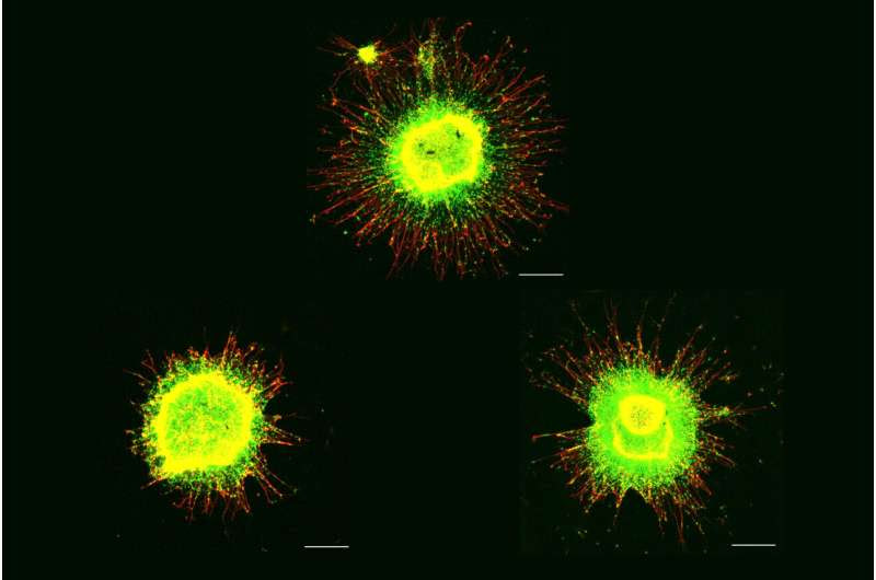 In Down syndrome cells, genome-wide disruptions mimic a senescence-like state