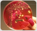 Scientists identify single genetic change in Salmonella that plays key role in bloodstream infections