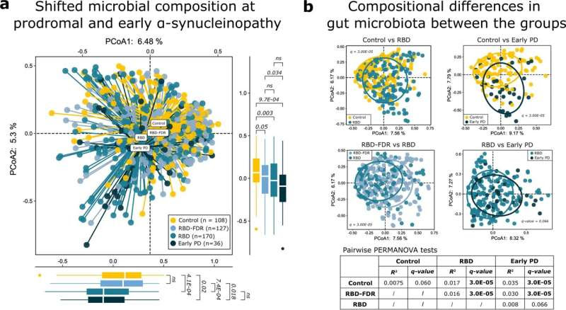 Early signals of Parkinson's found in gut microbiota of REM sleep behavior disorder patients