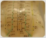 Acupuncture helps manage menopausal symptoms, review finds