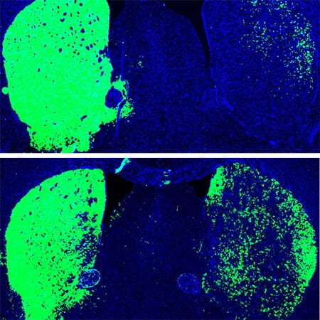 One-time treatment generates new neurons, eliminates Parkinson's disease in mice