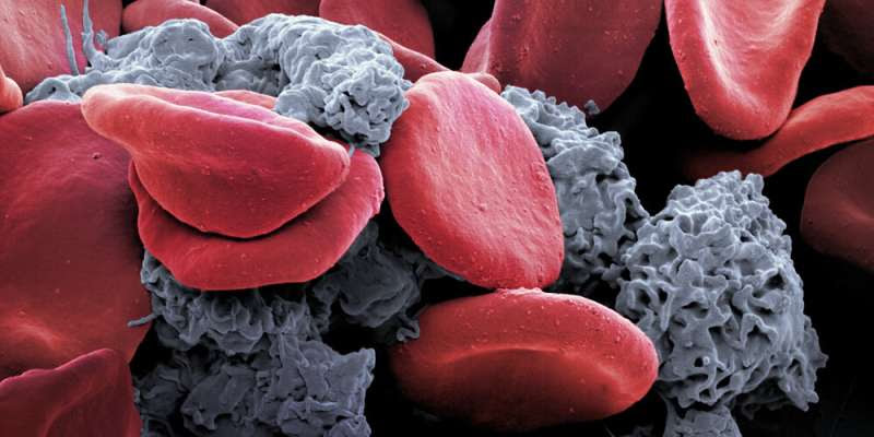 Keep on moving: Sports relieve tumor-associated anemia