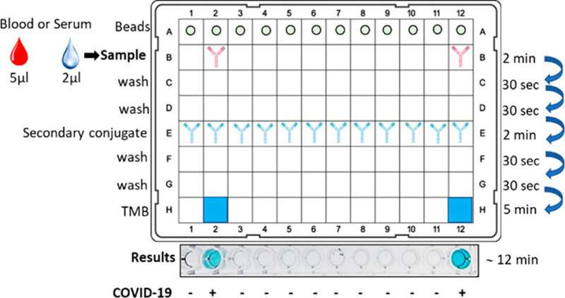 New rapid test to detect coronavirus antibodies developed