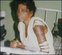 Tortured Sri Lankan maid