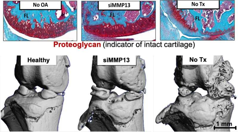 Biomedical engineers demonstrate potential for the first clinically successful osteoarthritis drug