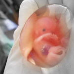 1280px-human_fetus_10_weeks_-_therapeutic_abortion-1
