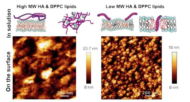 Composition of joint lubricant potential culprit behind osteoarthritis