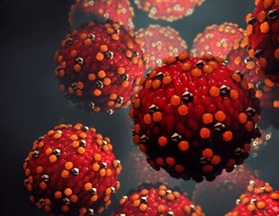 Measles warning in Western Australia