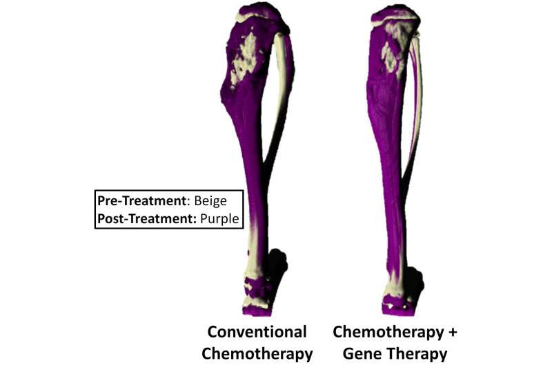 Novel combination of gene therapy and chemotherapy may provide new treatment option in bone cancer