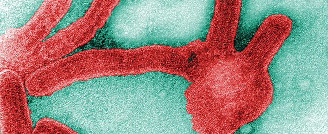 image of Marburg Virus from CDC