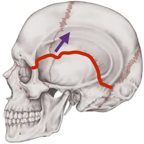 天蓋骨縫合の引き上げ.png