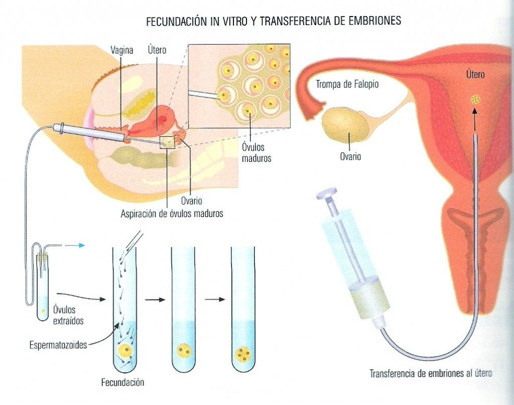 Ovulos de progesterona como se ponen