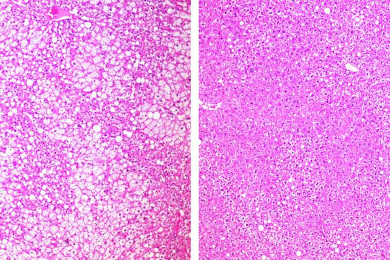 Drug mimics beneficial effects of fasting in mice