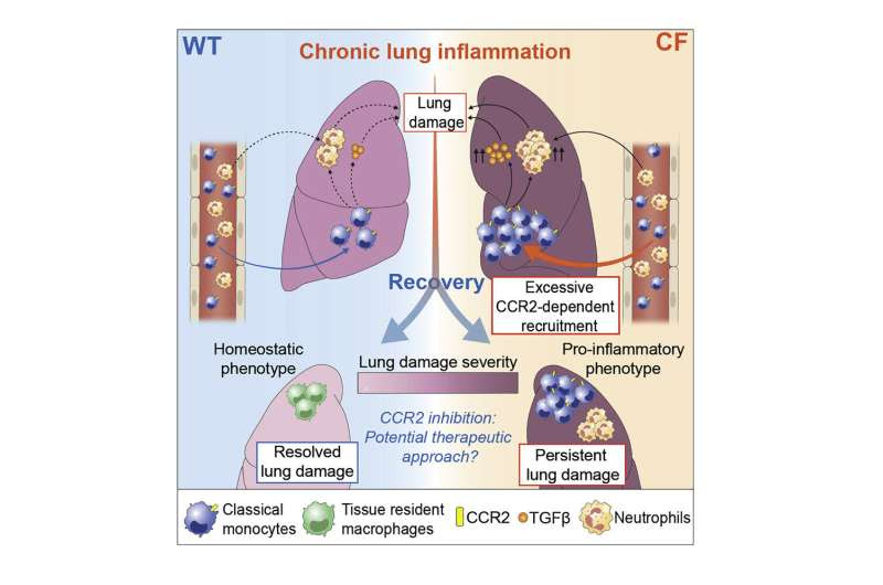 Driver of cystic fibrosis lung inflammation yields target for treatment