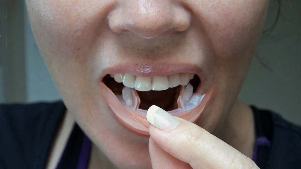 A person applying a whitening strip to their teeth.