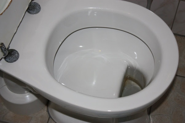 Why do German toilets have a shelf? Main-qimg-17b25b5110f4bdab560d49b2055624ac