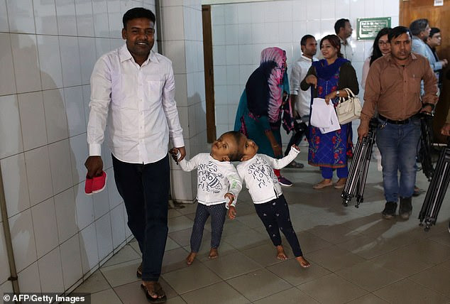 Born in 2016 to primary school teachers Rafiqul Islam and Taslima Khatun, the pair amazed doctors with their ability to walk and talk