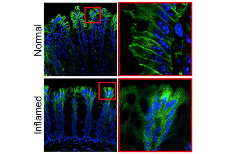 Scientists reveal mechanism for colon pain and inflammation