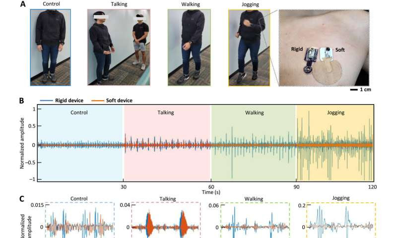 A soft wearable stethoscope designed for automated remote disease diagnosis